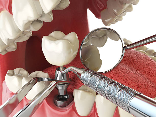Best After-Hours Emergency Dentist in Cumberland, IN